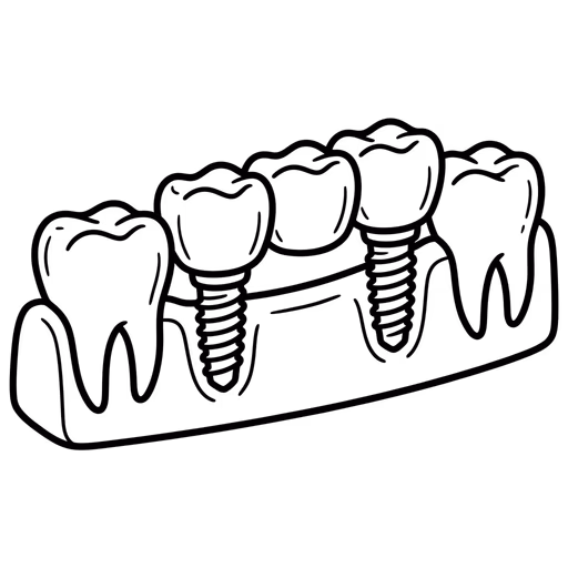 Line drawing of several missing teeth replaced together on dental implants