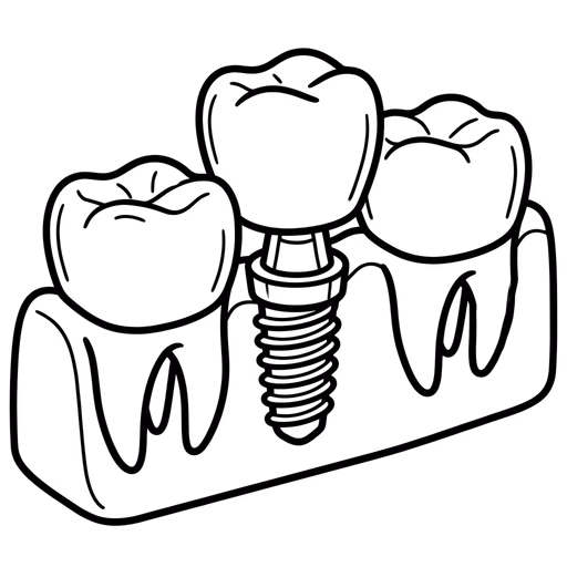 Line drawing of one dental implant set into the jaw between two natural teeth