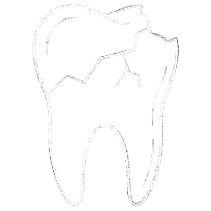 Chalk illustration of a broken tooth